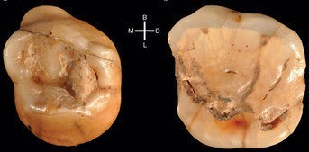 denti