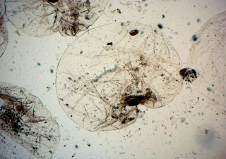 Noctiluca scintillans